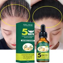 이끼키우기 탈모 헤어케어 원형탈모 엠자 M자 풍성 모발, 한개옵션0