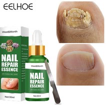 BT 손발톱 무좀치료제 진균 리페어에센스 케어제 발톱연화 무좀 관리, 30ml, 2개