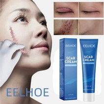 EELHOE 흉터 연고 여드름흉터연고 수술흉터연고 켈로이드성 화상 흉터 치료 재생 겔