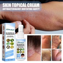 건선크림 아토피 피부습진 완화 크림 가려움방지 크림 보습제, 30ml