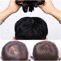 내츄럴컬러 남성용 정수리 o형 탈모 부분 가발 뚜껑 인모 숱 커버 헤어 피스 똑딱이 붙임 셀프 간편한 착용 티안나는 머리 카락 자연스러운 뒷머리 옆머리 동안 얼굴 패션 미용 소품