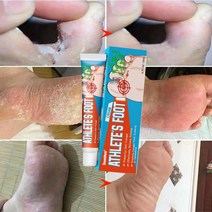 BT 무좀약 연고 발톱무좀 치료 발냄새 제거 발 가려움 연고, 20g, 2개
