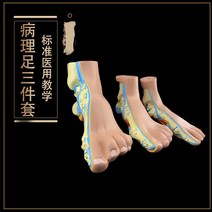 [족부 모형 총3세트] 인체 평발 정상 발 편평족 요족 하이힐 건강 신발 의원 병원 설명 교재 모델, 정상족