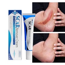 흉터제거연고 화상연고 켈로이드연고 수술 흉터 연고 흉터 제거, 20g*1, 1개