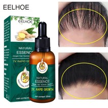 Ginger Hair Growth Products Fast Growing Essential Oil Anti Loss Scalp Treatment for Men Women Beaut, 한개옵션0