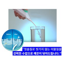 휴대용 워터 치아 치간 세정기 물칫솔 물치실 물양치, 1