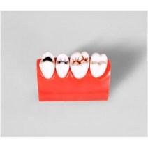 치아 모형 교육 치위생 관리 모양 덴티폼 치과놀이 구강 재료상, M4013