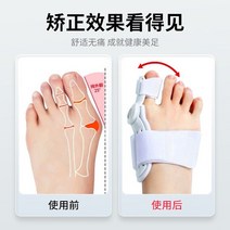 발가락 교정기 교정 검지 무지외반 엄지 평발 독일의 큰 여성 머리는 신발 를 신을 수, 화이트코렉터 프리프레스 투팩, 원 사이즈자동 조절