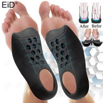 eid orthotic insoles for xo-legs correction orthopedic flat feet heel pain 아치 지원 for man woman shoe
