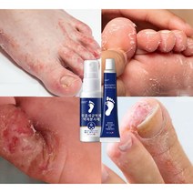 BT 무좀 스프레이 연고 약 발톱 각질 발바닥 발가락 간지럼 발 관리 풋케어, 30ml 15g, 2개, 2개
