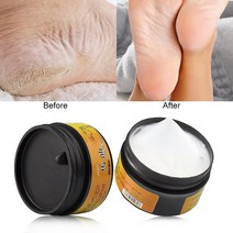풋크림 발크림 말 오일 피트 뒤꿈치 운동 선수의 마스크 가려움증 물집 관리 용 안티, 01 단일