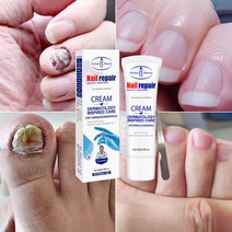 발톱 무좀약 발톱치료 연고 손톱 네일 리페어, 20ml, 1개