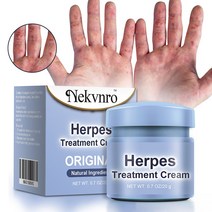 Nekvnro 건선 진고포지 루성피부염 접촉피부염 두피 건선 피부 가려움증 완화, 1개, 20g