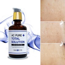 스킨아이 AC 퓨어토탈솔루션스킨+로션+에센스올인원 (+여드름클렌징폼 20ml 1인1개 증정), 1개, 100ml