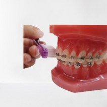 e75덴탈 교정칫솔15개 1세트 교정용칫솔, 15개