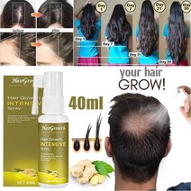 두피토닉 탈모완화 두피앰플 헤어케어 남자 여자 발모 에센스 뷰티 발모 리퀴드 모발 오일, 50ml