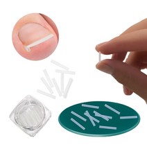 내성 발톱 자가 치료 교정기 파고드는 내향성 발톱 커브스틱 50P, ☞ 발톱관리커브스틱 50p