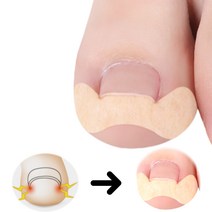 내성 발톱 보호 테이프 셀프 교정 밴드 30pcs
