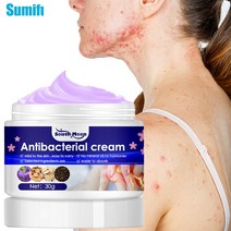 30g Psoriasis Cream Skin Care Antibacterial Relief Dermatitis Eczematoid Eczema Rash Urticaria Anti-, [01] 30g without box