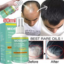 탈모에센스 샴푸 MOSSLAY 50ml 모발 성장 스프레이 생강 에센셜 오일 트리트먼트 탈모 방지 회복, [02] 50ml