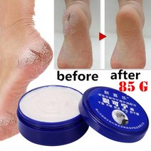 풋크림 발보습제85g 중국 전통 오일 안티 드라이 크랙 풋 크림 힐 금이 간 리페어 제거 죽은 피부 핸드 피, 한개옵션1, 01 85g