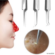 피지제거기 짜기 코 얼굴 블랙헤드 압출 바늘, 바늘루프형