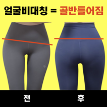 하이힙 얼굴비대칭 교정기 안면비대칭 틀어진골반 골반교정기 얼굴형교정