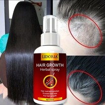 생강 모발 성장 스프레이 세럼 탈모 방지 에센셜 오일 제품 트리트먼트 숱이 건조 곱슬 수리, 50ml