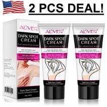 다크 스킨 스트롱 화이트닝 크림 전신 표백 라이트닝 브라이트닝 개입