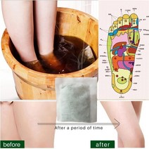 발족욕기 족욕통 발 담그기 중국 허브 발 목욕 분말 쑥 림프 배수 생강 해독 바디 케어, 10개