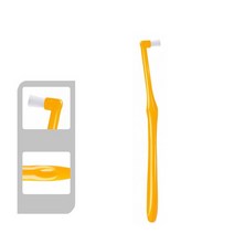 치간 교정 칫솔 작은 머리 부드러운 머리카락 교정 치아 교정기 치실 구강 치아 관리 1 개, 노랑머리