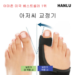 [속달 발송] HANLU 발가락 교정 밴드 무지외반증 발가락교정기