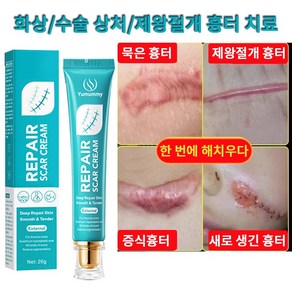 피부 관리 흉터 연고 화상 흉터 연고 화상연고