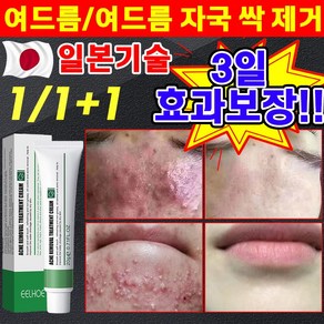 일본 1/1+1 여드름 제거 연고 색소침착 흉터 치료 리페 어 여드름 스팟 방지 문제 피부 케어 미백 재생 크림