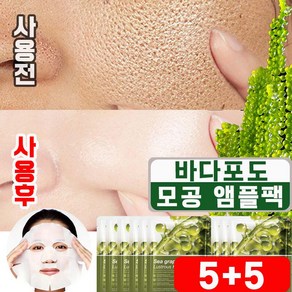 [피부과 추천] 5+5/10+10 바다포도 모공 수축 앰플 마스크팩 포어 리프팅 모공앰플 모공축소 팩 수분 진정 마스크팩 사은품 랜덤 증정, 10개, 10개입