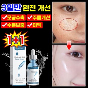 [피부과 추천] 1/1+1/2+2 저분자 히알루론산 앰플 원액 모공 수축 앰플 모공축소 에센스 주름개선 세럼 모공 리프팅 앰플 미백 보습, 2개, 30ml