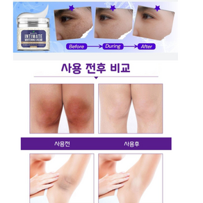 화이트닝 크림 검버섯 다크써클 검은입술 겨드랑이 Y존 색소침착 완화크림 [Beautzilla Intimate whitening cream]