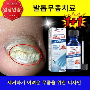 [국내배송]발톱 무좀 약 발톱무좀 발톱무좀치료 No.1 CLINICALLY PROVEN