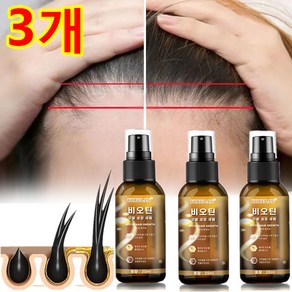 탈모 모발 활력 증진 모낭 보습 성장 촉진에센스, 20ml, 3개