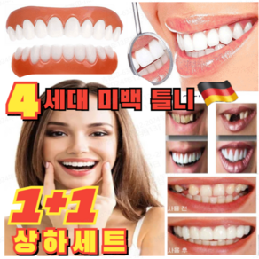 1+1 [국내배송]미백 틀니 4세대 미백 틀니 임시 치아 이빨 실리콘 모조 마우스피스 상하세트, (1+2)상하2개세트*3, 3개