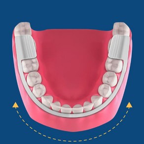수면치아보호 치아관리 이악물기 방지 수면용 마우스피스 가드 슬립케어 3708EA hyosungmake*879526629TU, 1개
