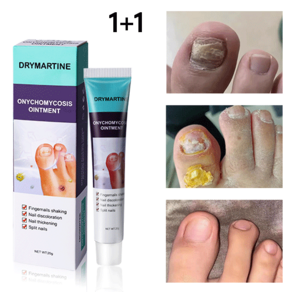 DRYMARTINE 발톱 케어 크림 발톱 건강 관리 발톱 변색 완화 발톱 촉촉함 유지, 2개, 20g