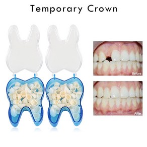 5pcs 치과 임시 치아 전방 후부 재료 액세서리 도구, 단일옵션, 5개