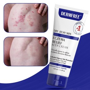 DERMFREE 바디크림 두드러기 피부 가려움 크림