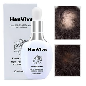 HanViva 헤어 발모제 두피 양양제 헤어에센스 머리 케어 모낭 보습 성장 촉진 에센스, 1개, 20ml