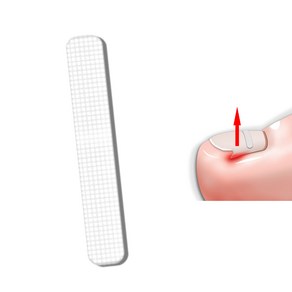 바이유즈 내성발톱 케어밴드팁 교정팁, 1세트, 50개입