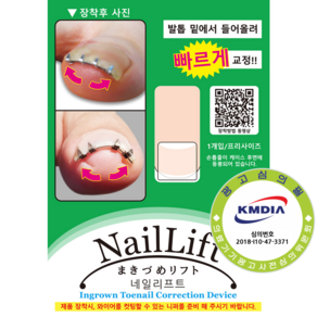 내성발톱 교정기기 네일리프트 NailLift, 1개