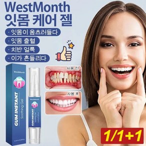 1/1+1 WestMonth 잇몸케어 젤 잇몸 부기구강 케어 잇몸질환예방, 2개