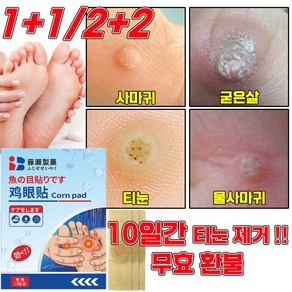 [당일 발출] 티눈제거 발바닥 통증 완화 티눈밴드 보호테이프 손가락 발가락 티눈뿌리 제거 패치, 2개