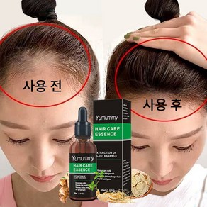 Hai Hai Gowe 두피 케어 세럼 발모제, 4개, 30ml